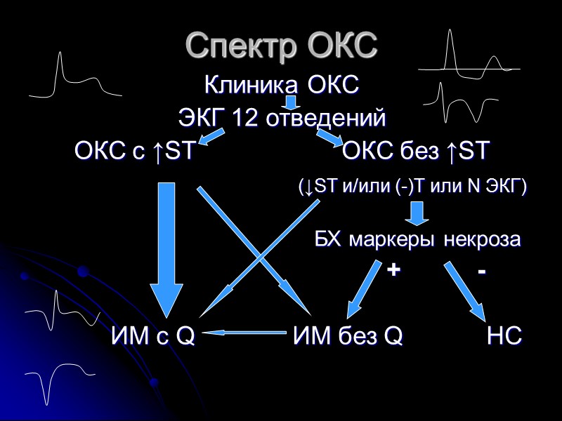 Спектр ОКС Клиника ОКС ЭКГ 12 отведений ОКС с ↑ST    